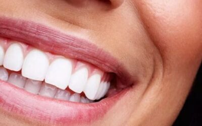 Full Mouth Reconstruction & Reviews by Patients