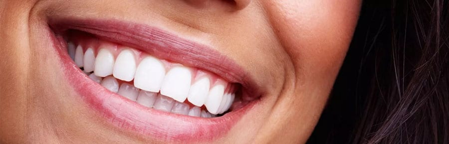 Full Mouth Reconstruction & Reviews by Patients