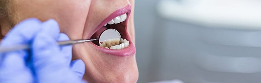 Overview of Bone Graft Dental in Canada