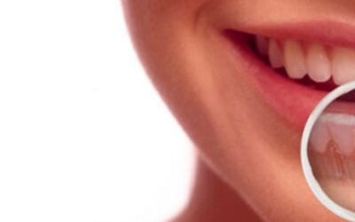 Going for Basal Implants in India