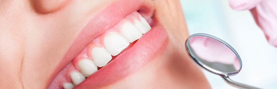 dental implants in India