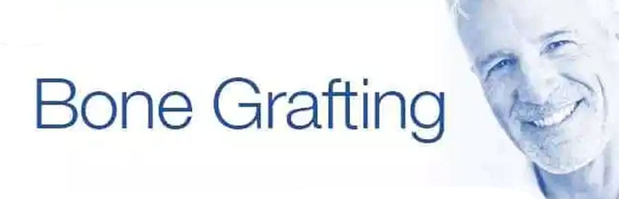 dental bone graft cost