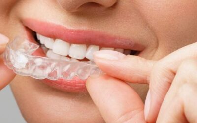 Protect Your Teeth While You Sleep With a Night Guard