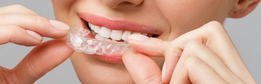 Protect Your Teeth While You Sleep With a Night Guard
