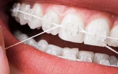 Why Flossing Is a Must for Healthy Teeth?