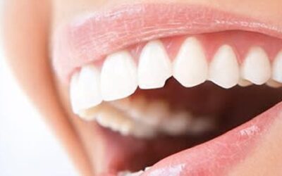 Why Are My Teeth Chipping Easily?