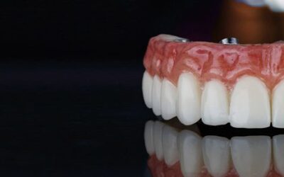 Benefits of a Zirconia Fixed Bridge