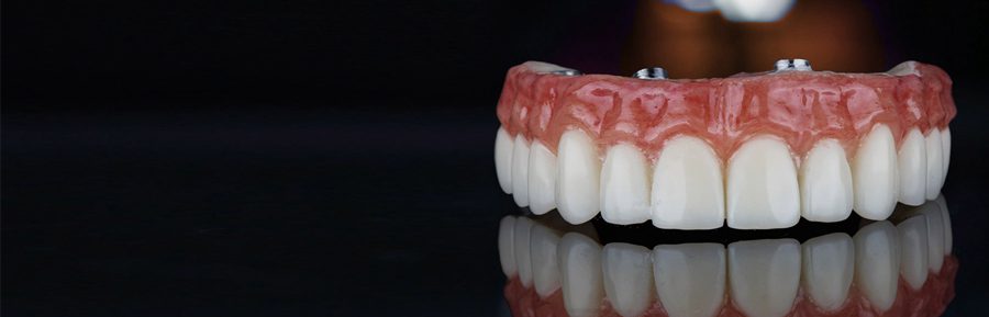 Benefits of a Zirconia Fixed Bridge