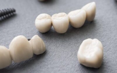 Dental Crown Myths – Debunked!