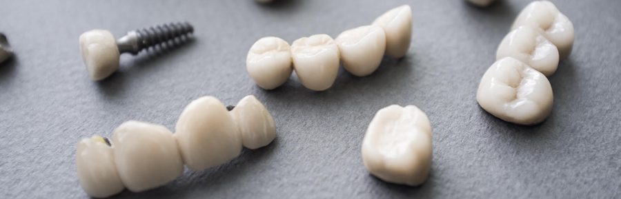 Dental crown myths debunked
