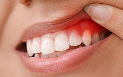 Gum Disease –  It Affects More Than Just Gums
