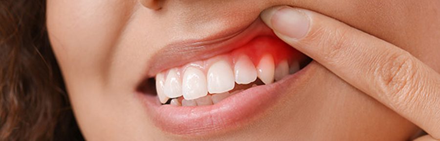 Gum disease – it affects more than just gums