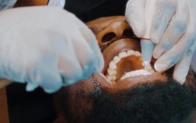 Why Wisdom Teeth May Not Be So Wise?