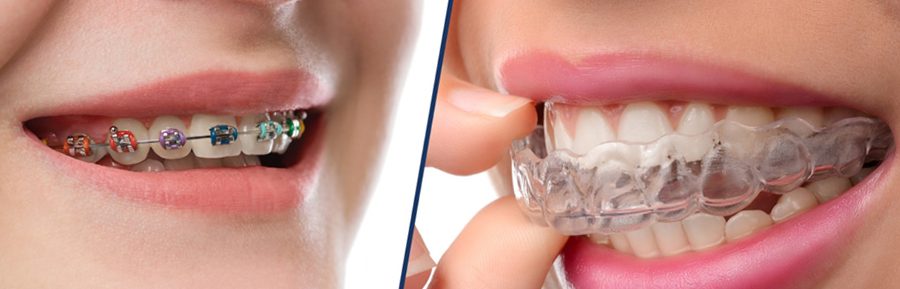 Brace Yourself: The Evolution of Orthodontics