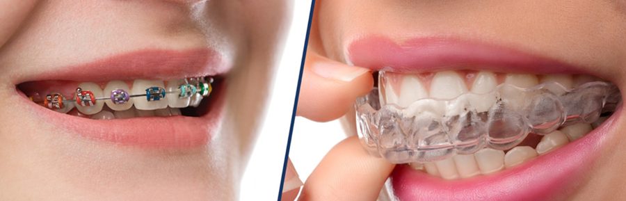 Brace yourself: the evolution of orthodontics