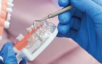 Debunking Dental Implant Myths: An Expert’s Perspective