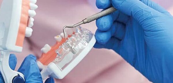 Debunking Dental Implant Myths
