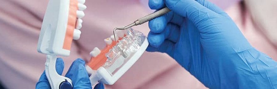 Debunking dental implant myths