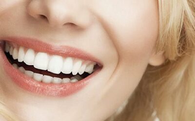 How Hollywood Stars Maintain Their Red Carpet Smiles