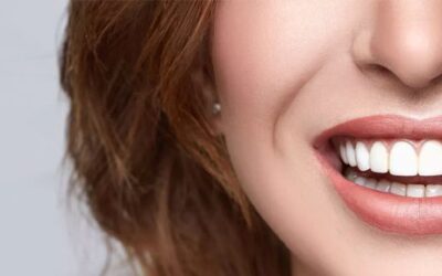 The Art of Smile Design: Crafting Your Perfect Expression