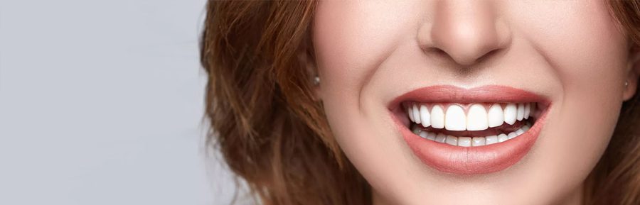 The Art of Smile Design: Crafting Your Perfect Expression