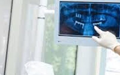 The Fascinating World of Dental Oddities: Unusual Anomalies