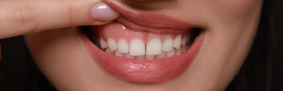 Zirconia Crowns on Basal Implants: The Future of Smile Transformations