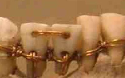 The Ancient Secrets of Oral Health: Historical Dental Practices