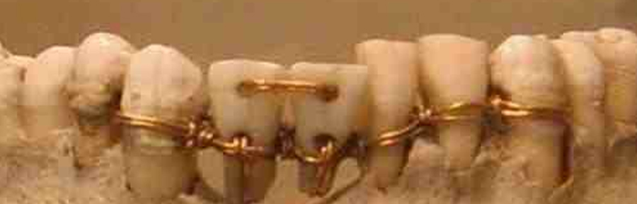 The Ancient Secrets of Oral Health: Historical Dental Practices