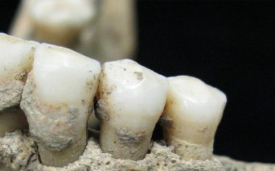 What Fossilized Teeth Reveal About Modern Dental Health