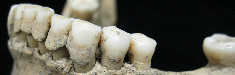 What Fossilized Teeth Reveal About Modern Dental Health
