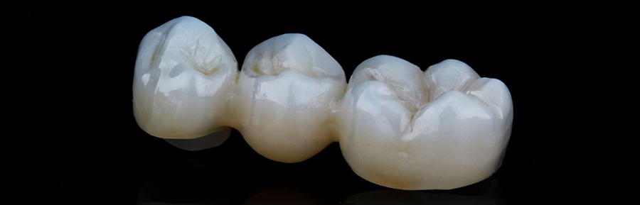 Zirconia Crowns: Enter the Era of Same-Day Restorations