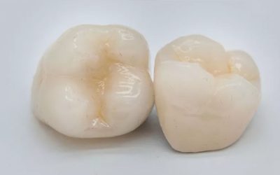 Zirconia vs. Nature: Can a Crown Be Stronger than Enamel?
