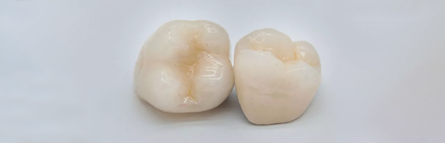 Zirconia vs. Nature: Can a Crown Be Stronger than Enamel?